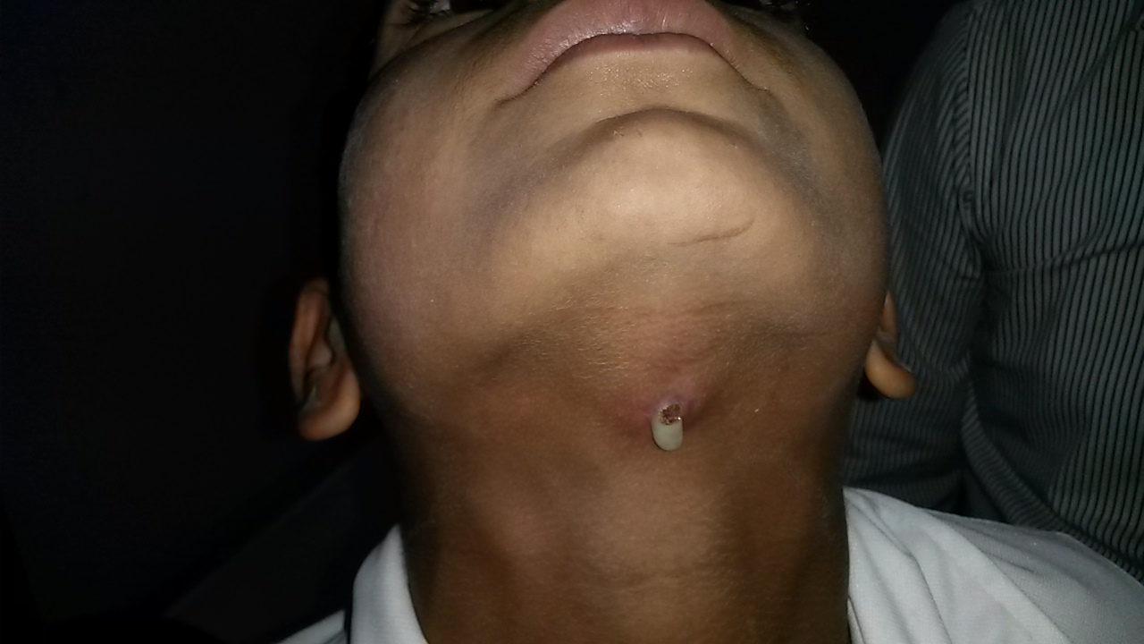 Pediatric General Surgery Image 2